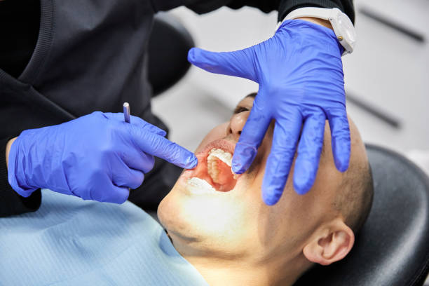 Best Cracked Tooth Emergency Dentist  in Santa Clara, NM