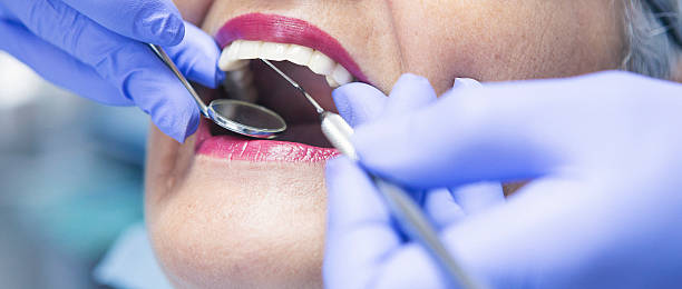 Best Knocked-Out Tooth Emergency  in Santa Clara, NM